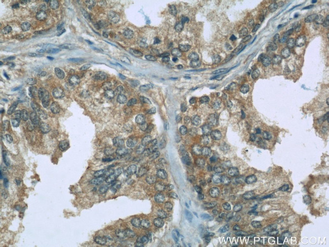 HRAS Antibody in Immunohistochemistry (Paraffin) (IHC (P))