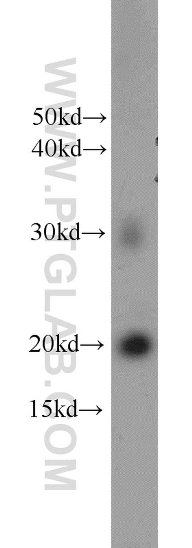 HRAS Antibody in Western Blot (WB)