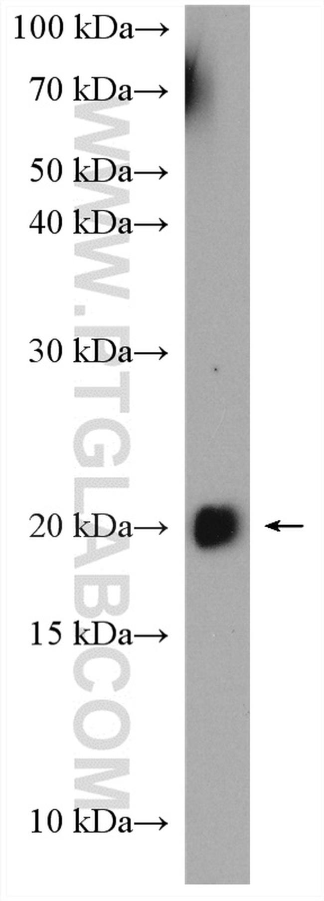 HRAS Antibody in Western Blot (WB)