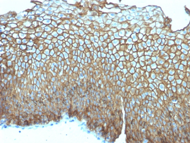 Desmoglein-3 Antibody in Immunohistochemistry (Paraffin) (IHC (P))