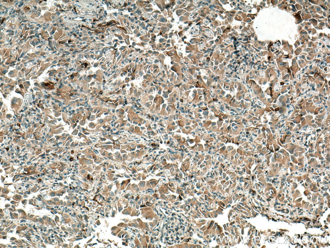 Thrombospondin 1 Antibody in Immunohistochemistry (Paraffin) (IHC (P))