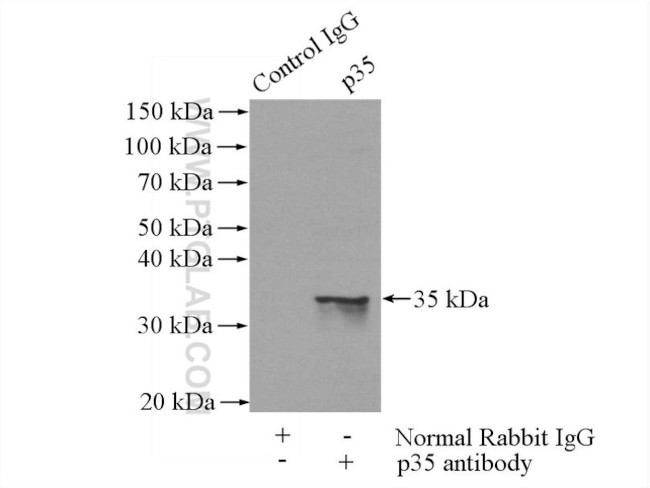 p35 Antibody in Immunoprecipitation (IP)