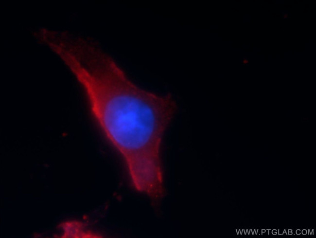 CACNG1 Antibody in Immunocytochemistry (ICC/IF)