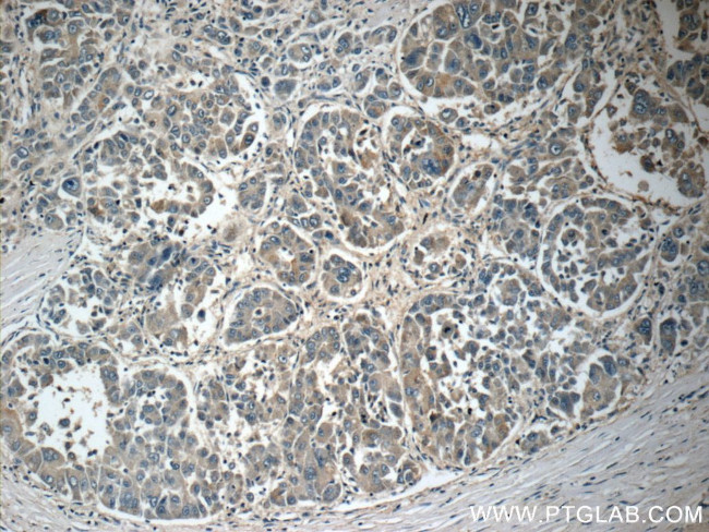 CACNG1 Antibody in Immunohistochemistry (Paraffin) (IHC (P))