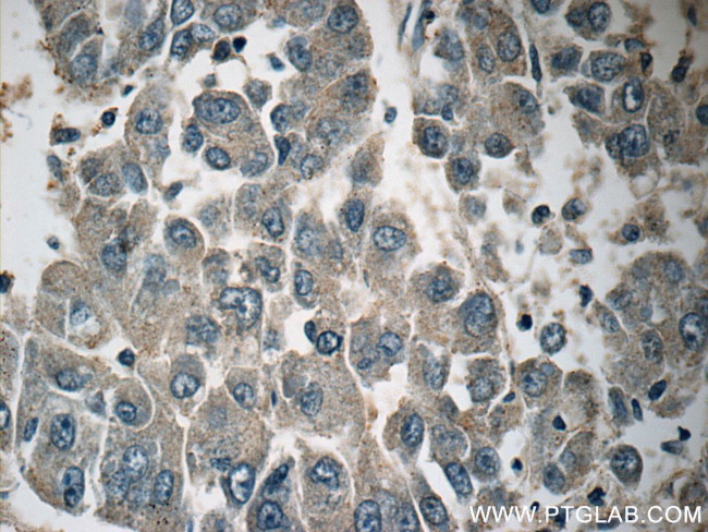 CACNG1 Antibody in Immunohistochemistry (Paraffin) (IHC (P))