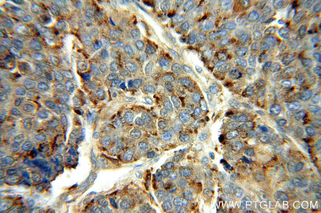 PSAP Antibody in Immunohistochemistry (Paraffin) (IHC (P))