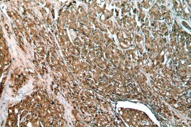 PSAP Antibody in Immunohistochemistry (Paraffin) (IHC (P))