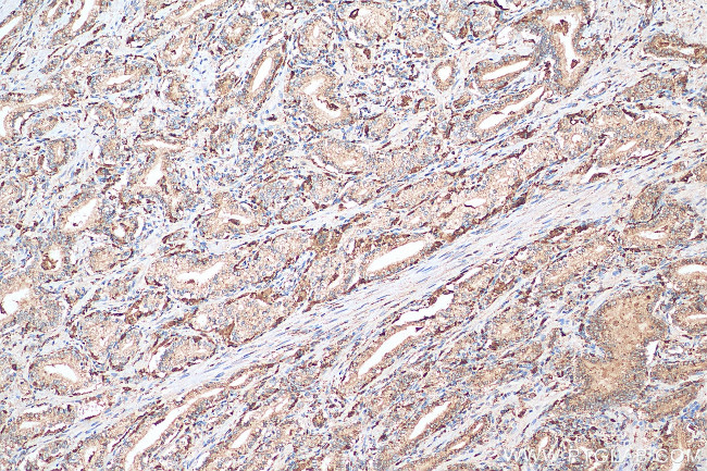 PSAP Antibody in Immunohistochemistry (Paraffin) (IHC (P))