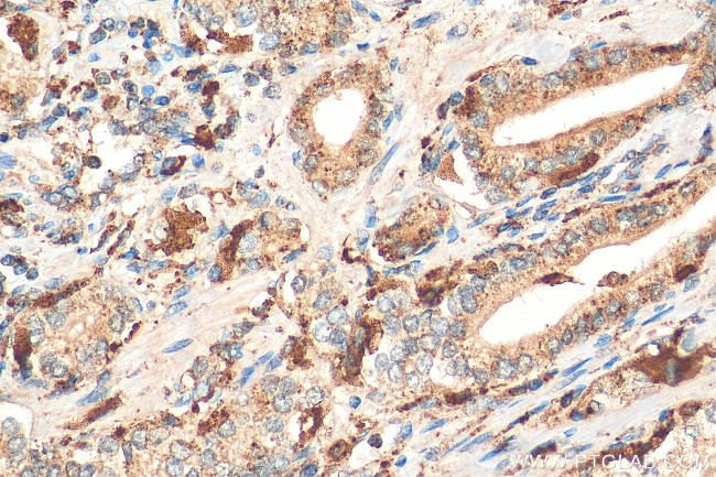 PSAP Antibody in Immunohistochemistry (Paraffin) (IHC (P))