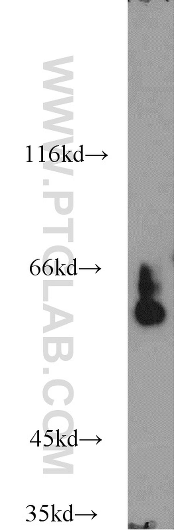 PSAP Antibody in Western Blot (WB)