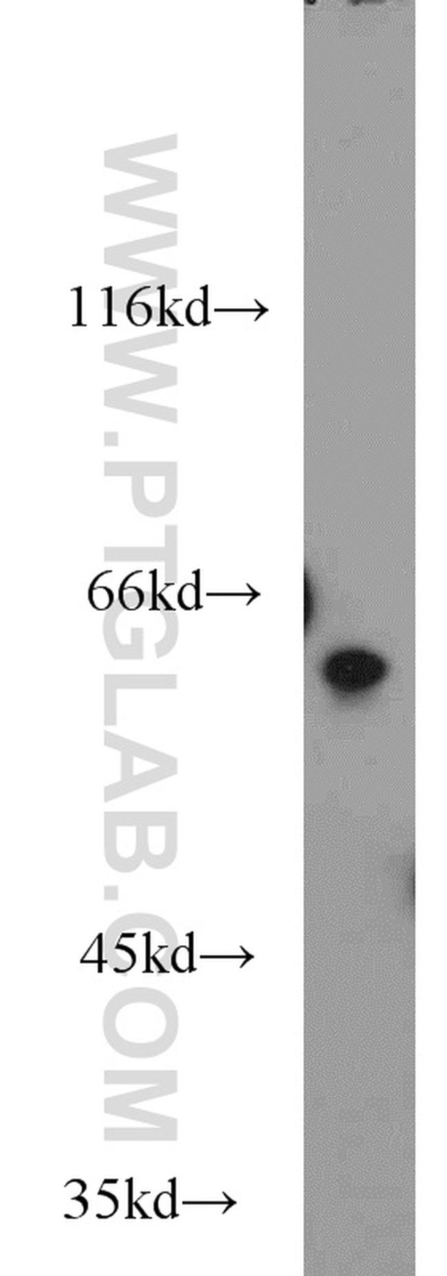 PSAP Antibody in Western Blot (WB)