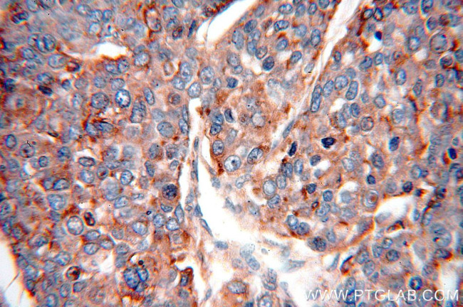 PSAP Antibody in Immunohistochemistry (Paraffin) (IHC (P))