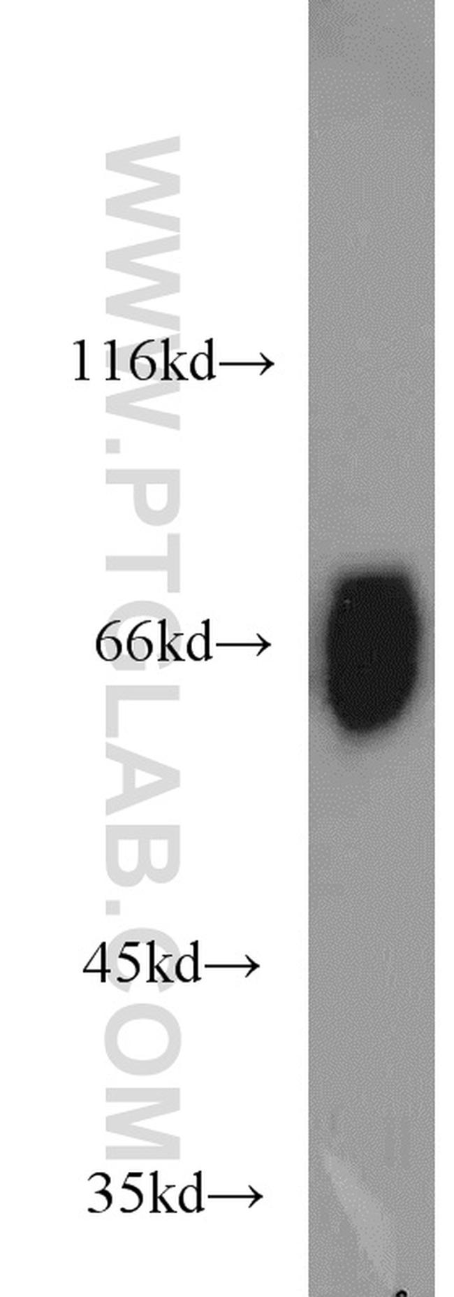 PSAP Antibody in Western Blot (WB)