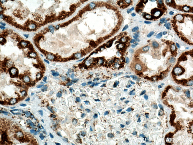 UQCRFS1 Antibody in Immunohistochemistry (Paraffin) (IHC (P))