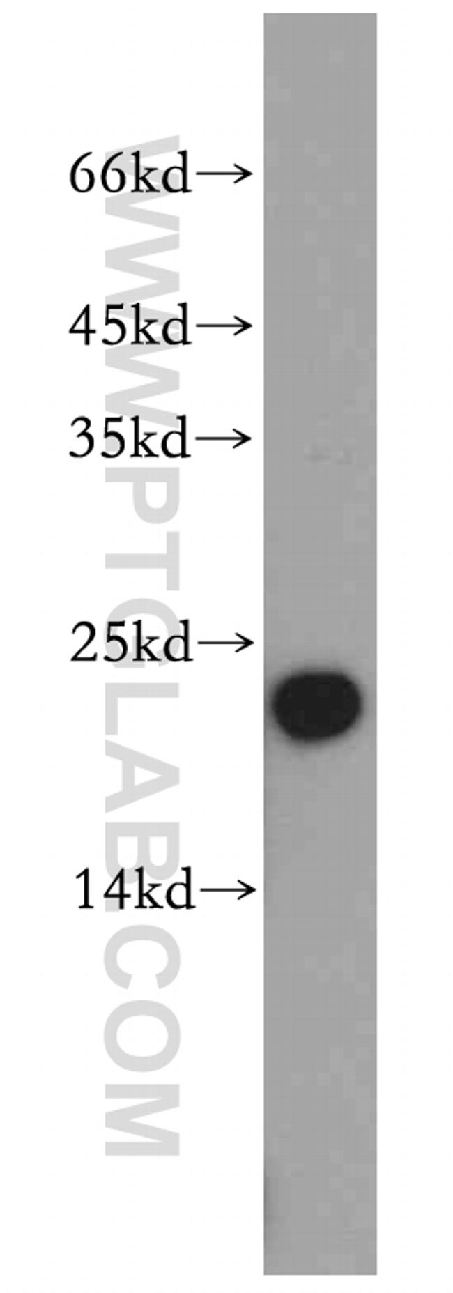 UQCRFS1 Antibody in Western Blot (WB)