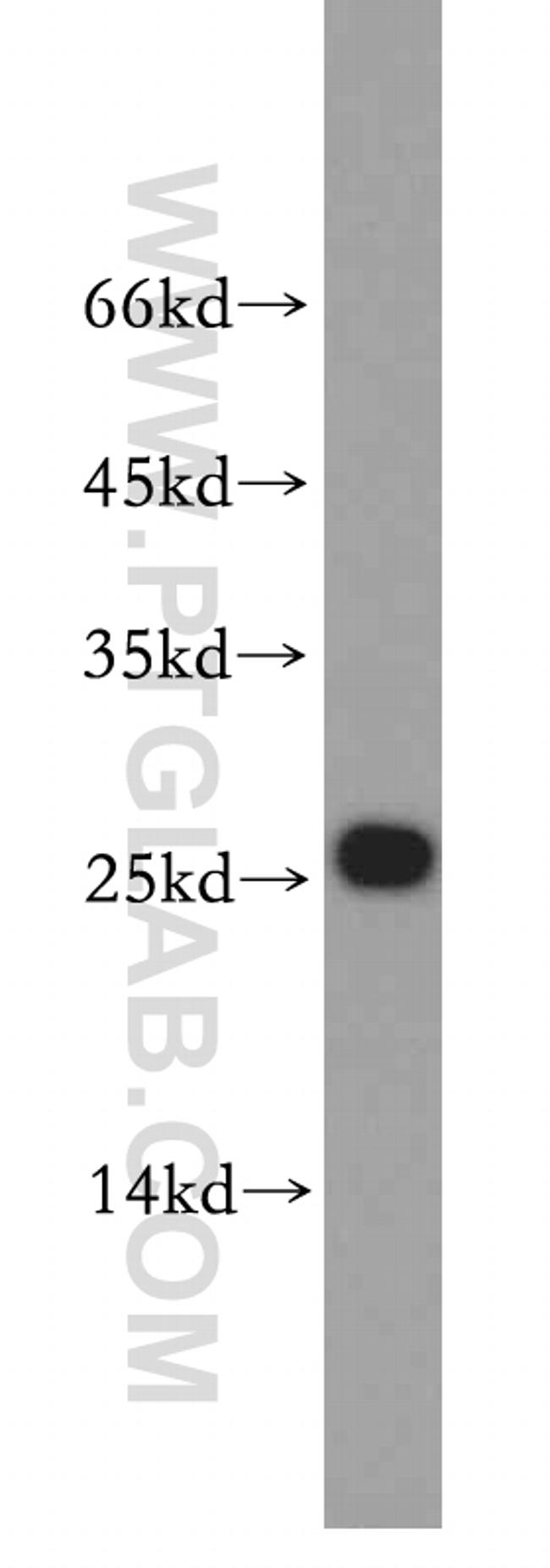 UQCRFS1 Antibody in Western Blot (WB)