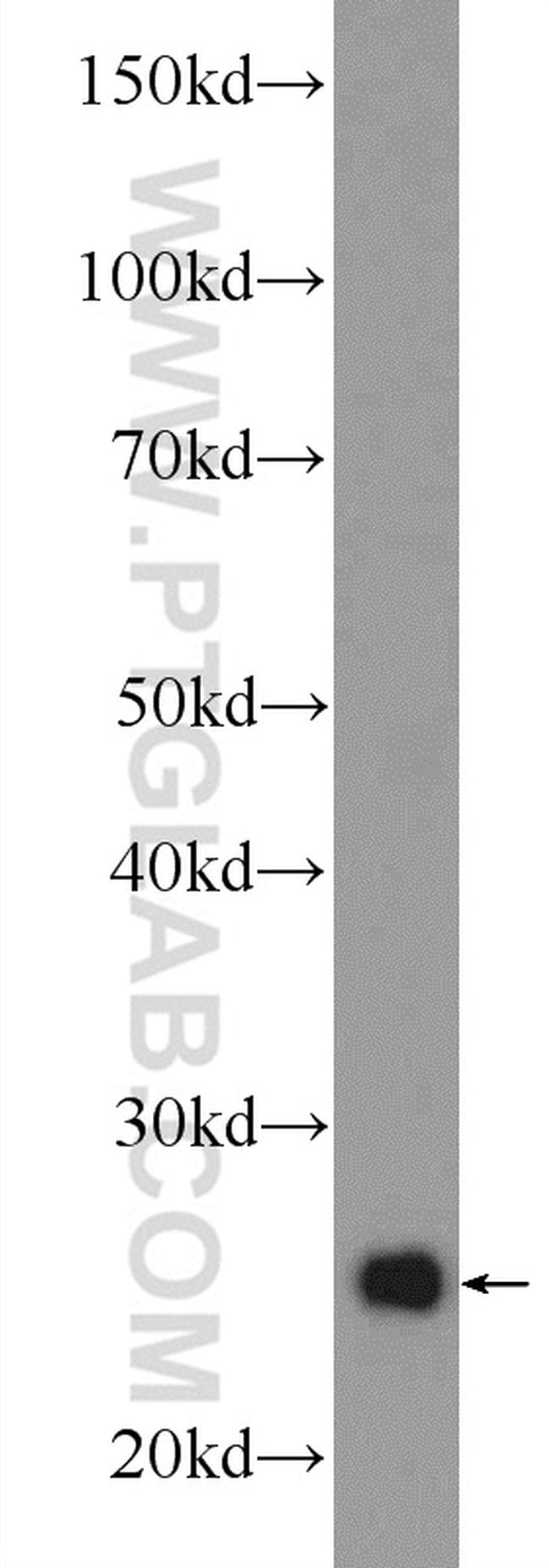 UQCRFS1 Antibody in Western Blot (WB)