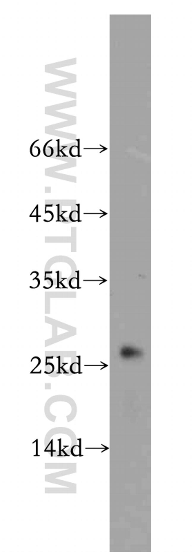 UQCRFS1 Antibody in Western Blot (WB)