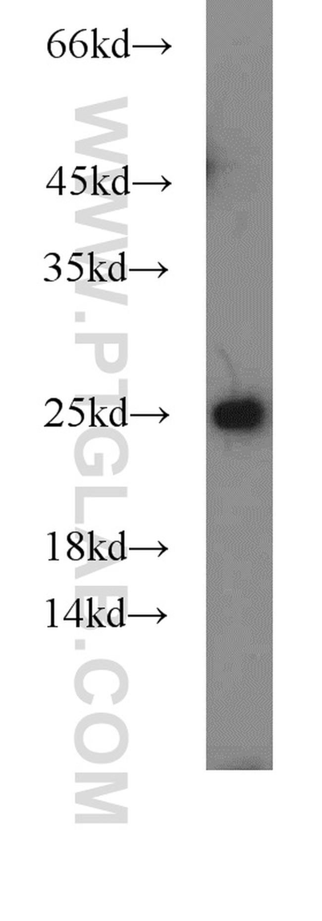 UQCRFS1 Antibody in Western Blot (WB)