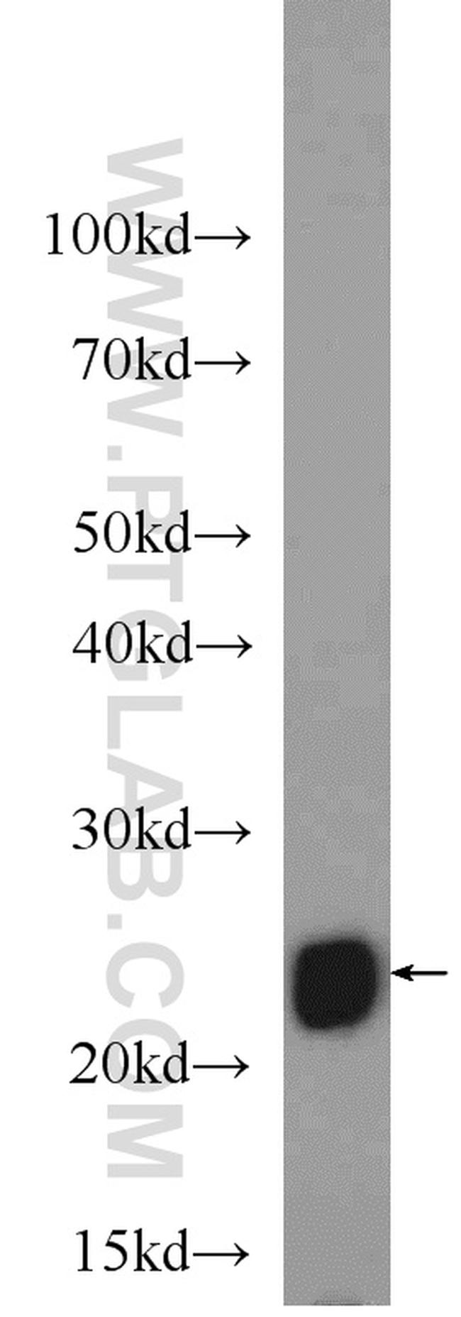 UQCRFS1 Antibody in Western Blot (WB)