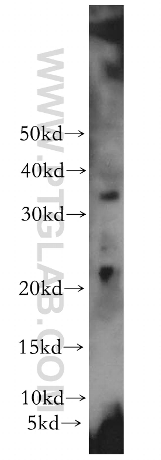 PPP1R14B Antibody in Western Blot (WB)