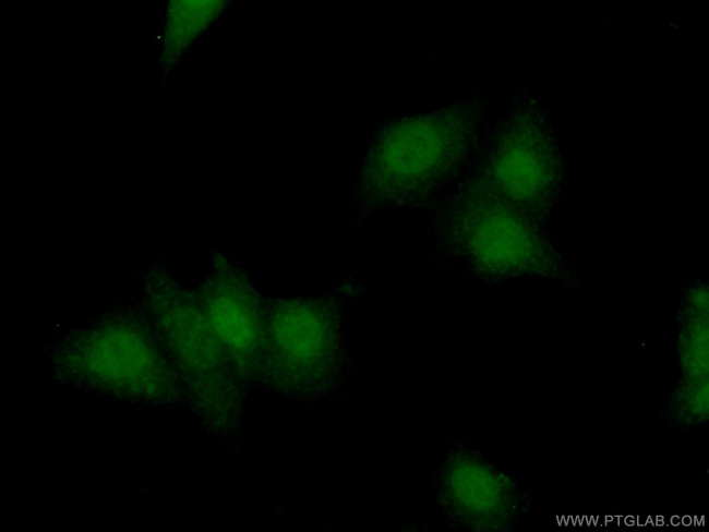 XRCC3 Antibody in Immunocytochemistry (ICC/IF)