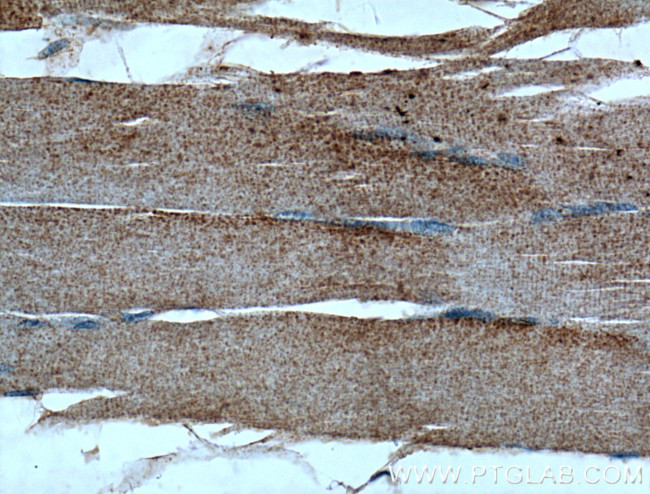 CLCN1 Antibody in Immunohistochemistry (Paraffin) (IHC (P))