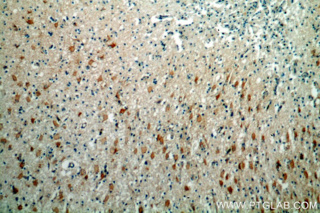 NUMB Antibody in Immunohistochemistry (Paraffin) (IHC (P))