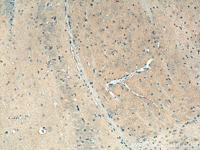 NUMB Antibody in Immunohistochemistry (Paraffin) (IHC (P))