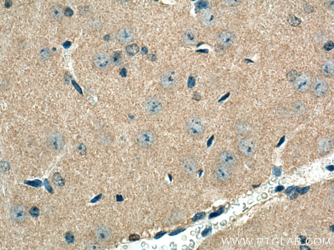 NUMB Antibody in Immunohistochemistry (Paraffin) (IHC (P))