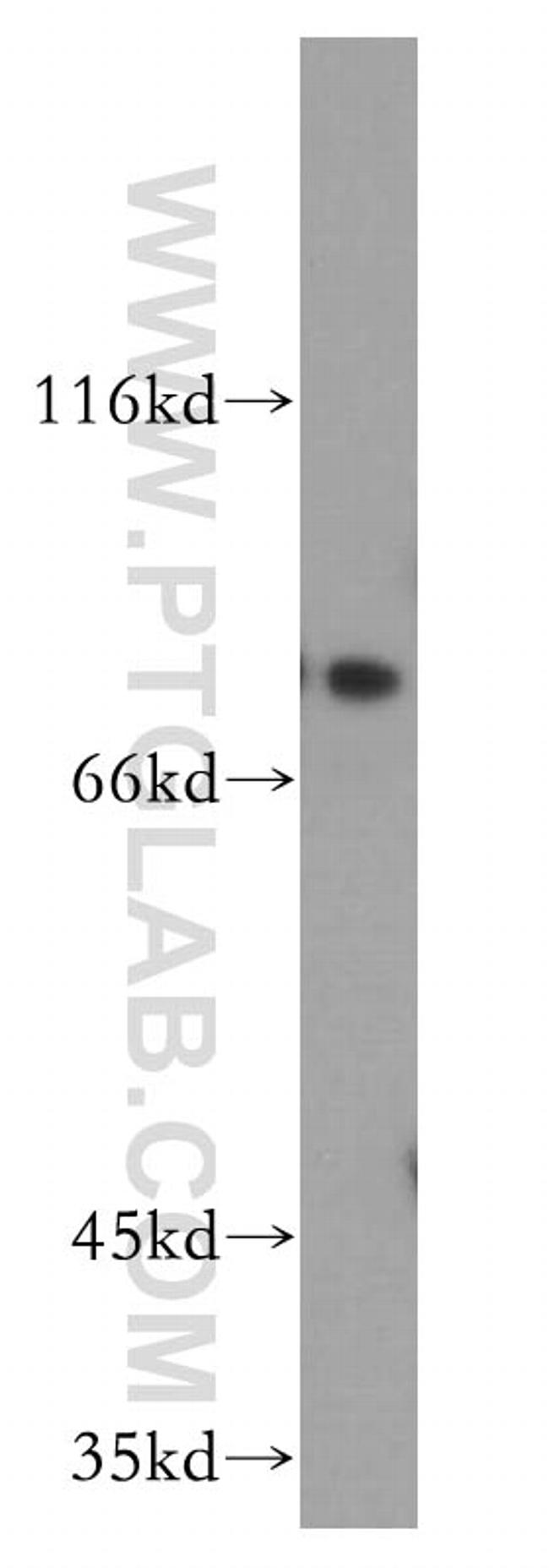 NUMB Antibody in Western Blot (WB)