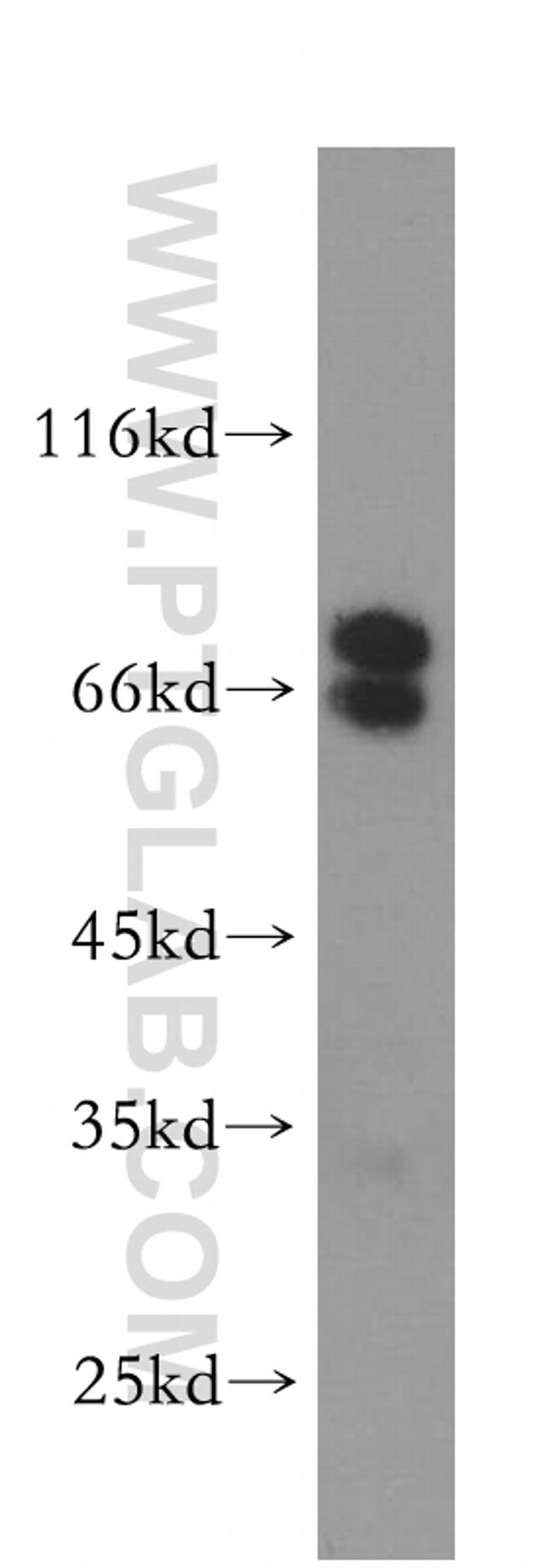 NUMB Antibody in Western Blot (WB)