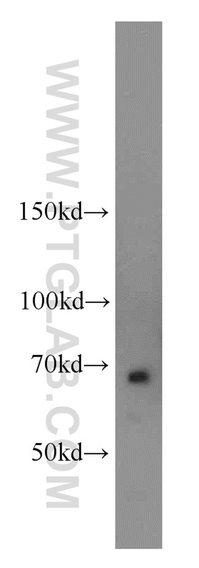 NUMB Antibody in Western Blot (WB)