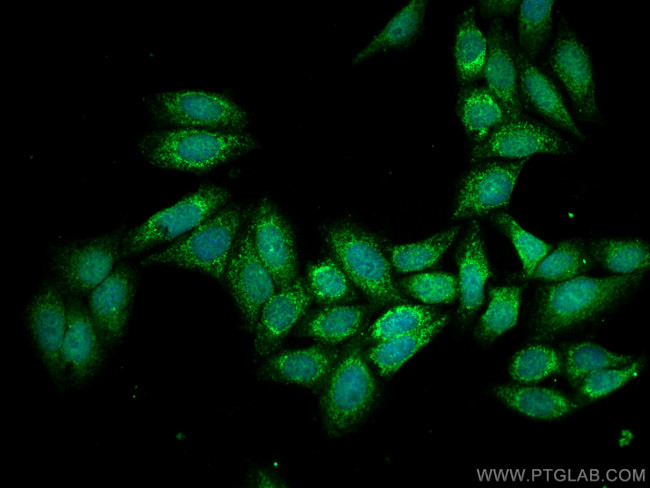 CPS1 Antibody in Immunocytochemistry (ICC/IF)