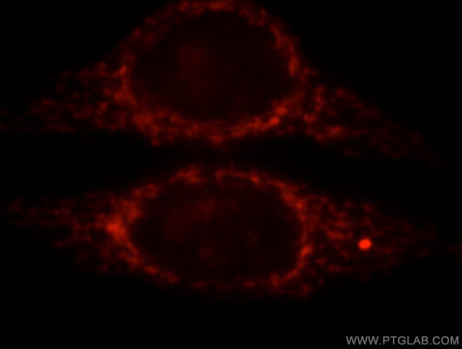 CPS1 Antibody in Immunocytochemistry (ICC/IF)