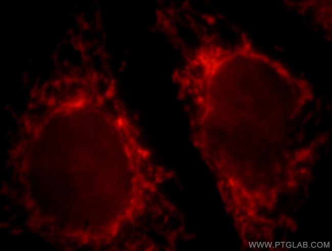 CPS1 Antibody in Immunocytochemistry (ICC/IF)