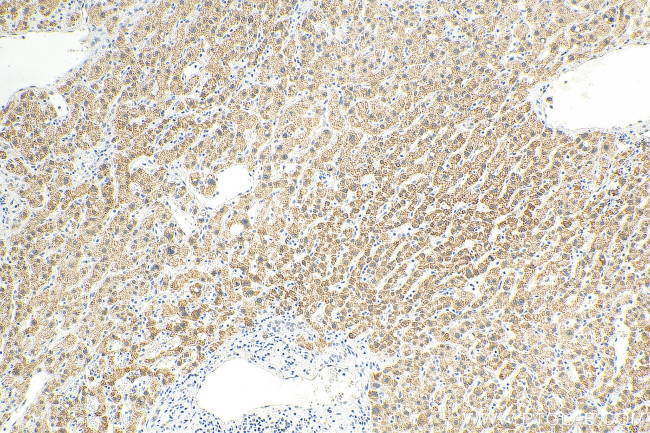 CPS1 Antibody in Immunohistochemistry (Paraffin) (IHC (P))