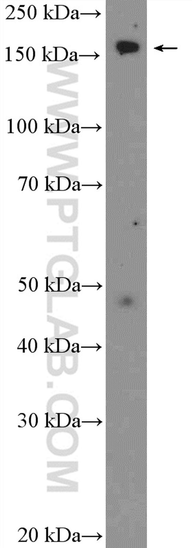 CPS1 Antibody in Western Blot (WB)