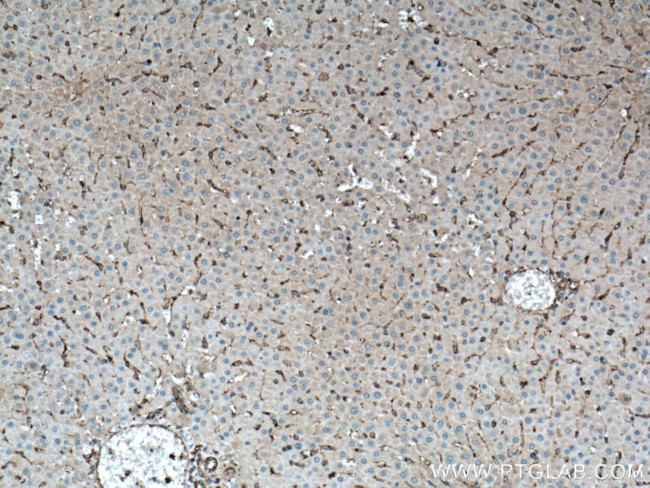 CD206 Polyclonal Antibody (18704-1-AP)