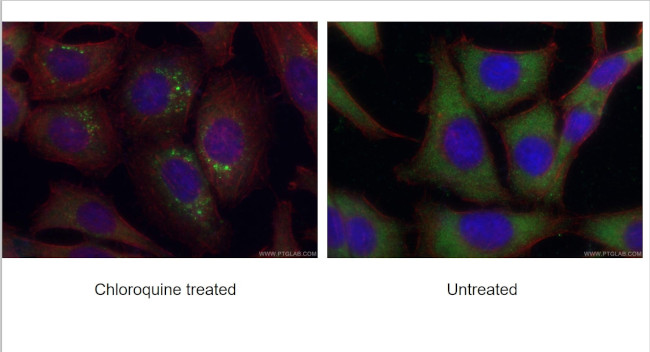 GABARAP Antibody in Immunocytochemistry (ICC/IF)