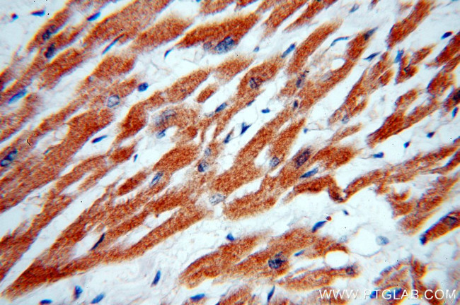 GABARAPL2 Antibody in Immunohistochemistry (Paraffin) (IHC (P))