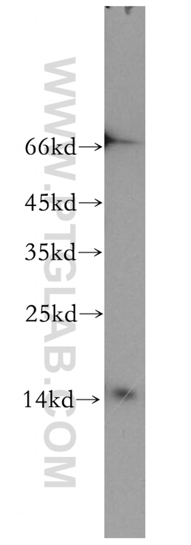 GABARAPL2 Antibody in Western Blot (WB)