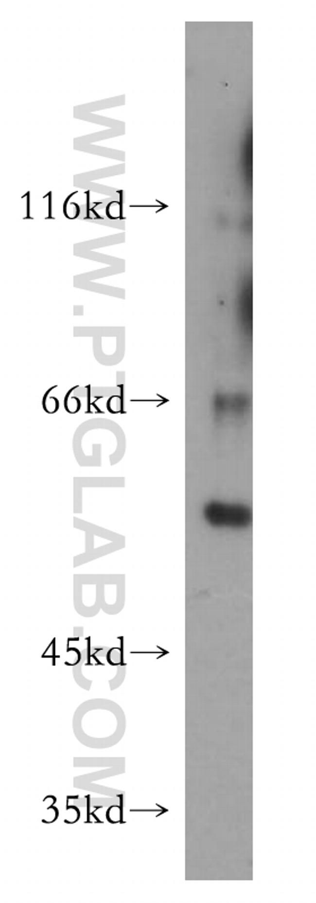 PDZD3 Antibody in Western Blot (WB)