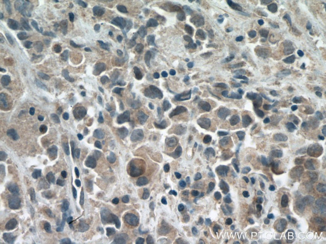 USP34 Antibody in Immunohistochemistry (Paraffin) (IHC (P))