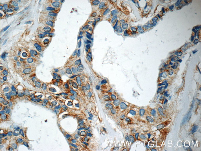 USP34 Antibody in Immunohistochemistry (Paraffin) (IHC (P))