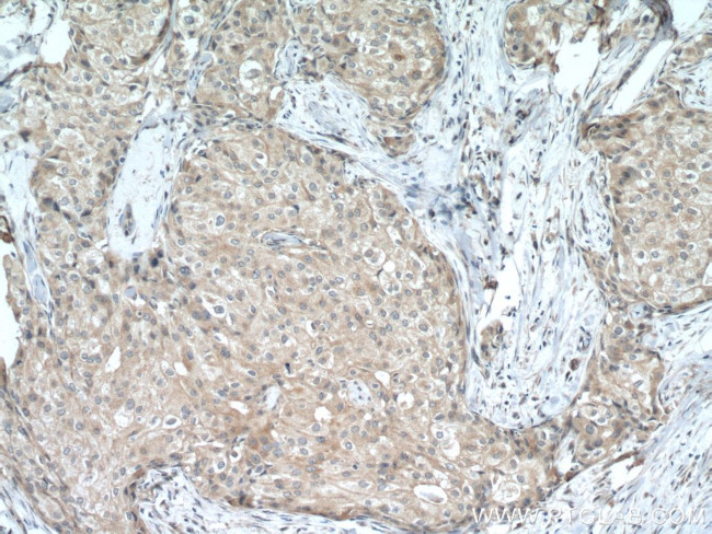 USP34 Antibody in Immunohistochemistry (Paraffin) (IHC (P))