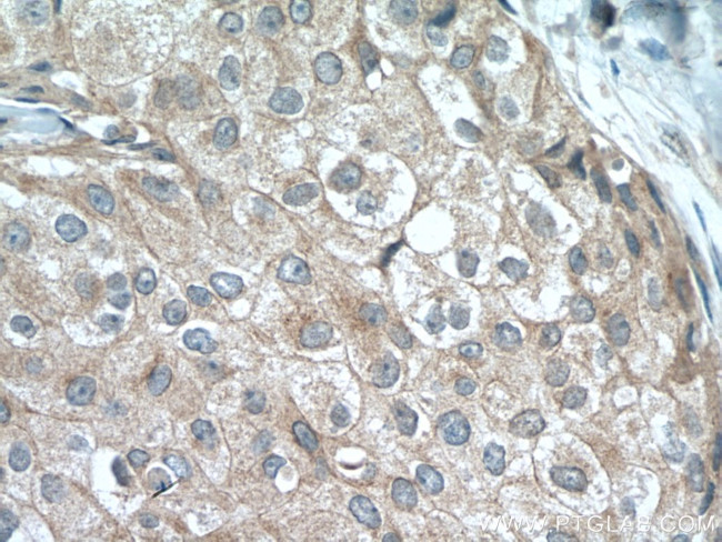 USP34 Antibody in Immunohistochemistry (Paraffin) (IHC (P))