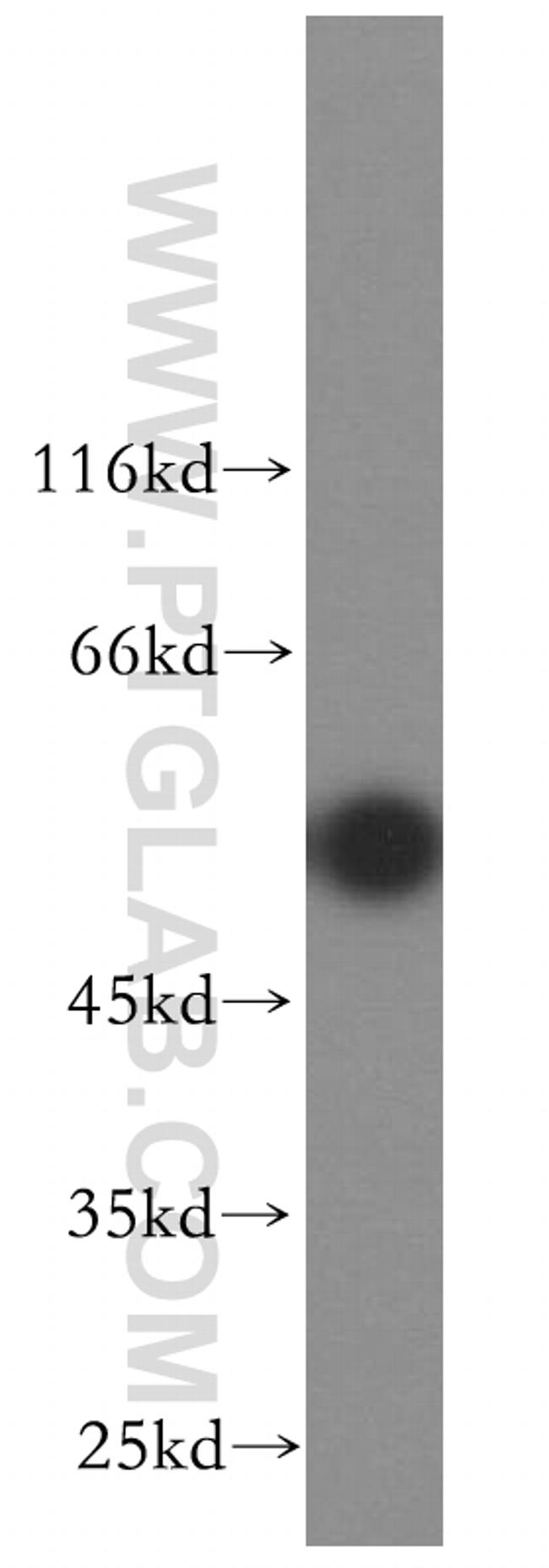 ENTPD8 Antibody in Western Blot (WB)