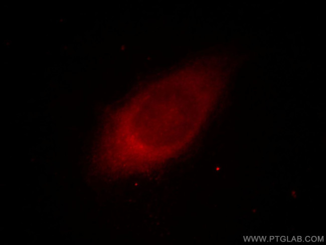 AKR1C4 Antibody in Immunocytochemistry (ICC/IF)