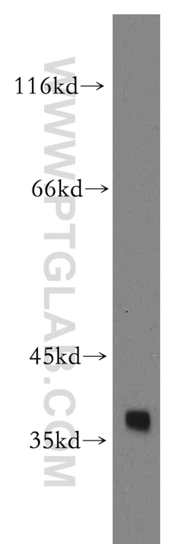 AKR1C4 Antibody in Western Blot (WB)